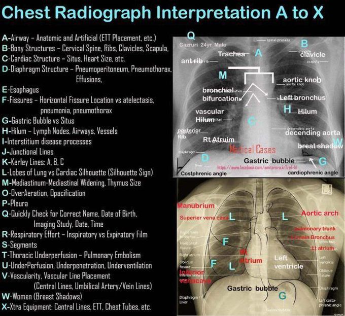 Cxr...