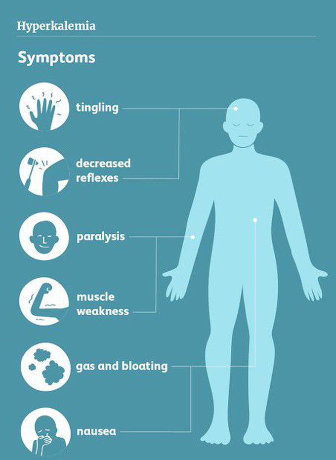 These are the symptoms of hyperkalemia