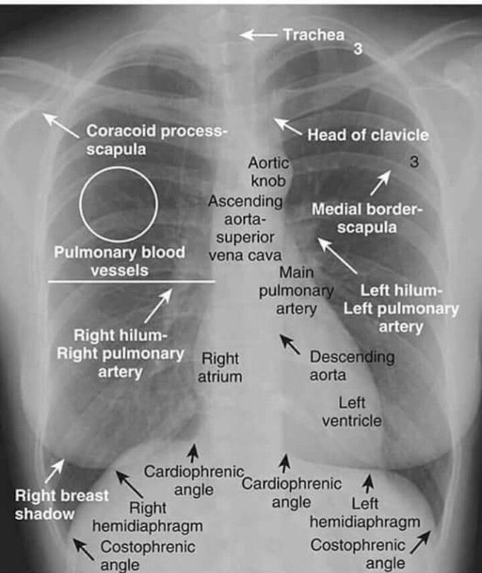 Normal chest x-ray