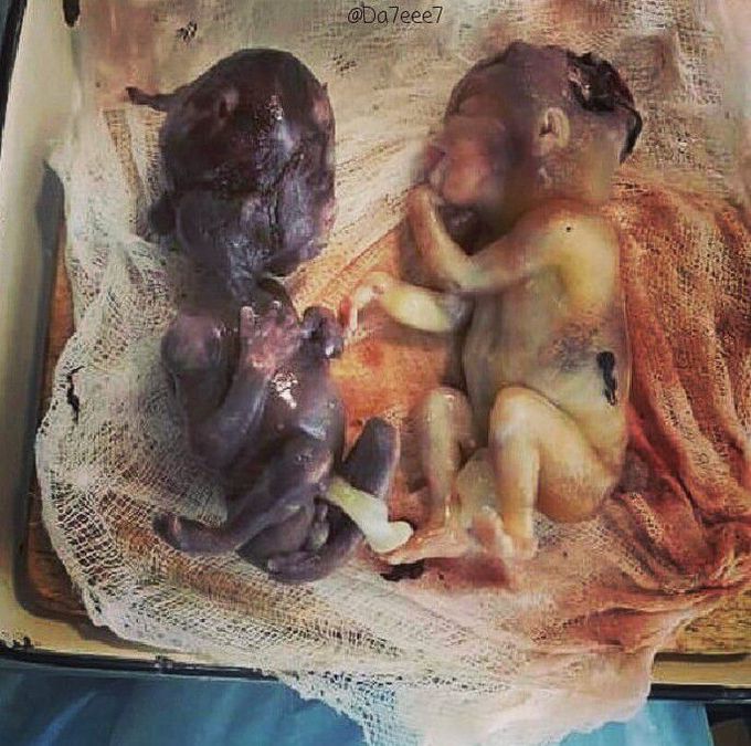 Identical Twins