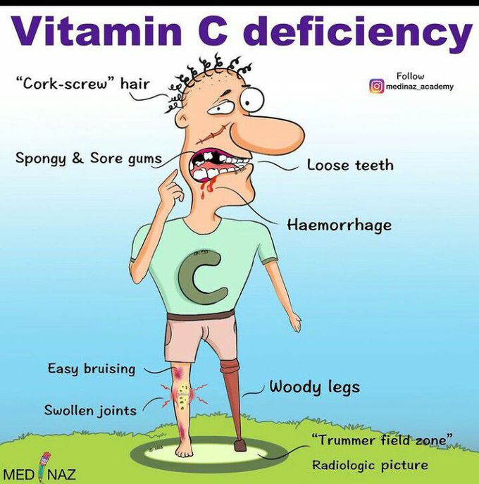 Vitamin C deficiency