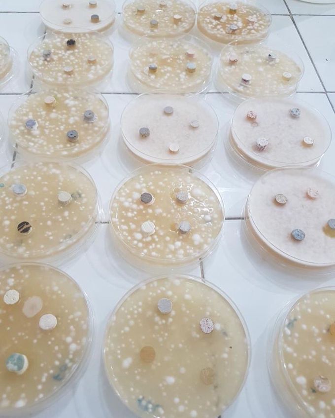 Microbiology of fungi lab