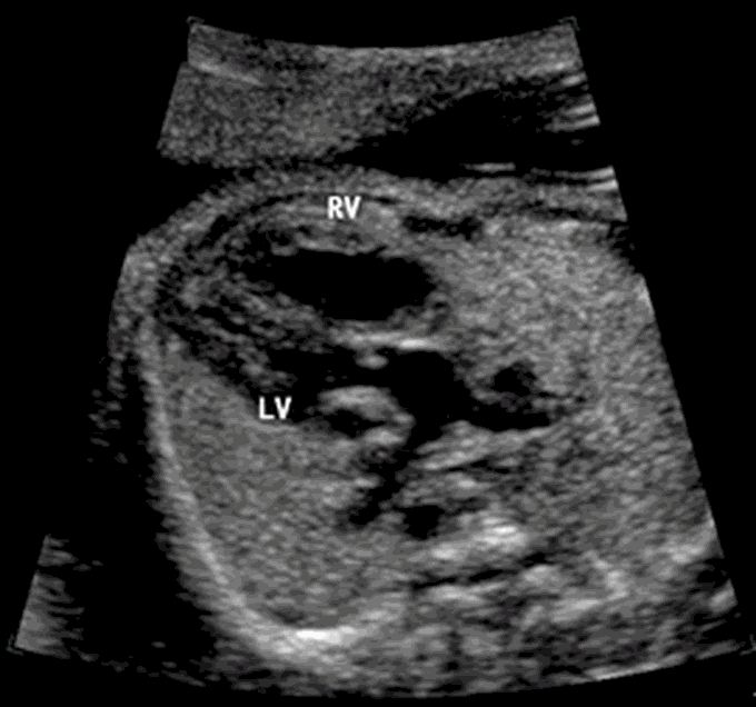 Guess the diagnosis! 