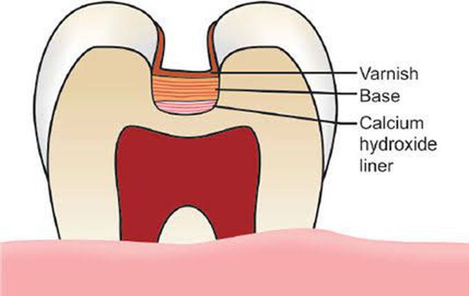 Cavity base