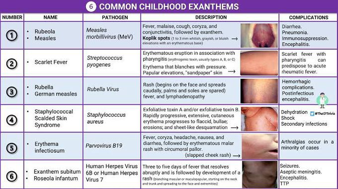 Common Childhood Exanthems