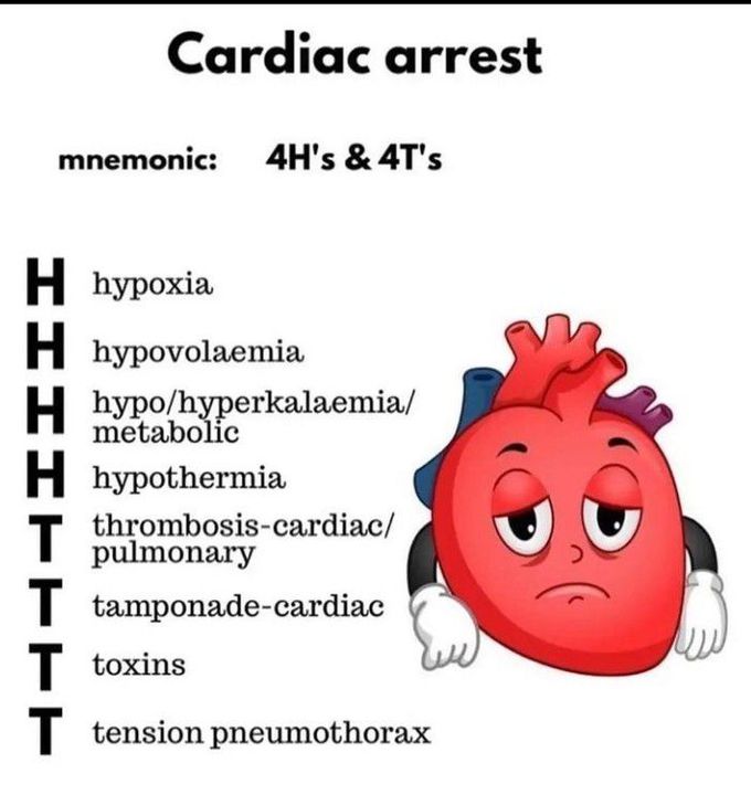 Mnemonic for cardiac arrest