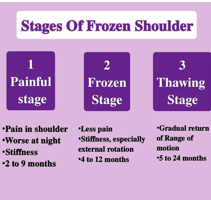 Stages of Frozen Shoulder