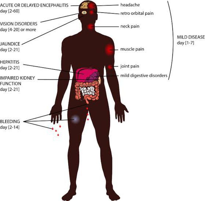 Rvf symptoms