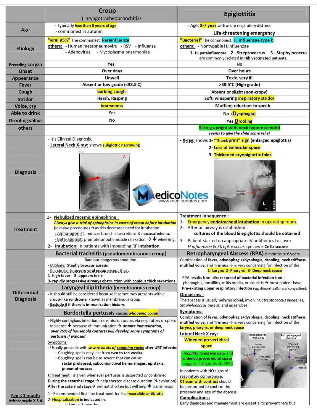 crup vs epiglotitis