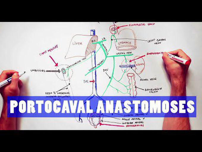 Portal-Systemic Anastomosis