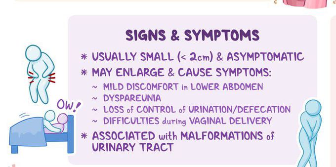 Symptoms of Gartner's duct cyst