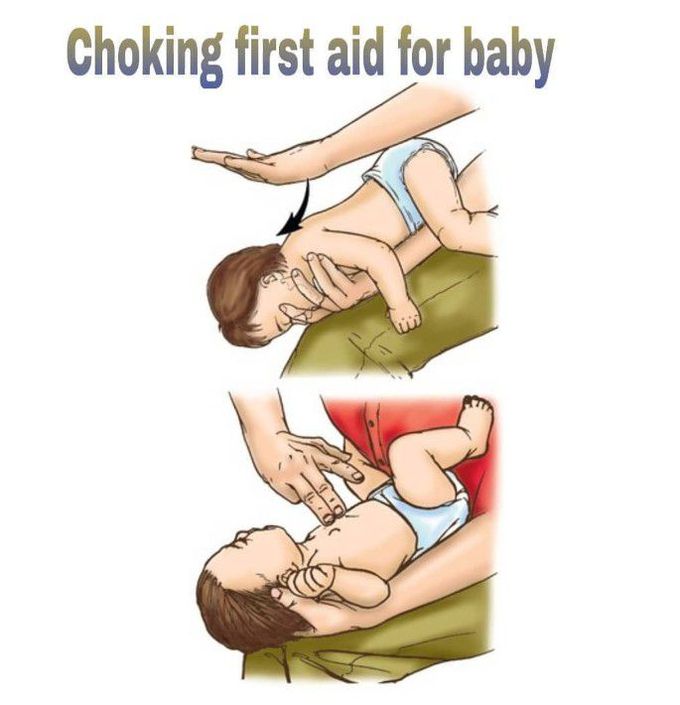 Baby choking deals first aid