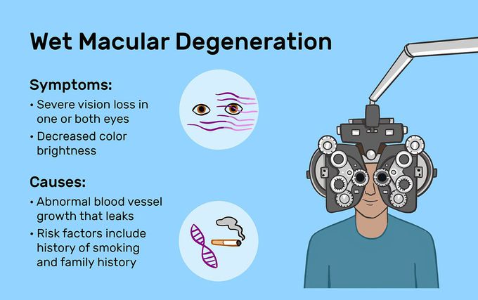 Symptoms of Wet Macular Degeneration