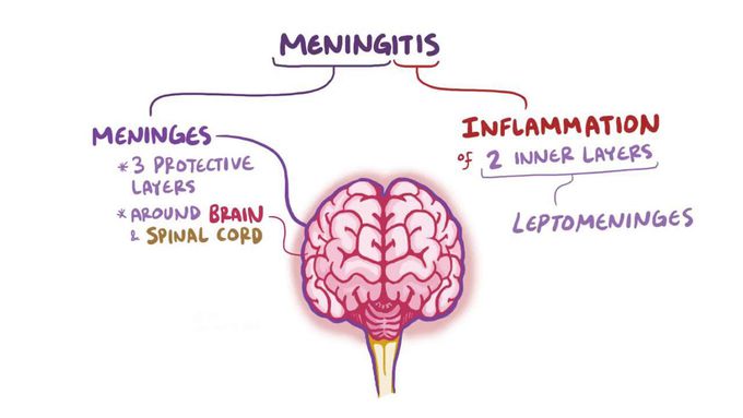 Meningitis