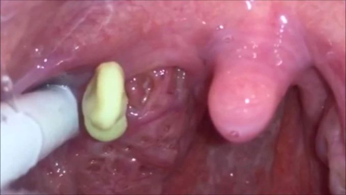 Medical Videos