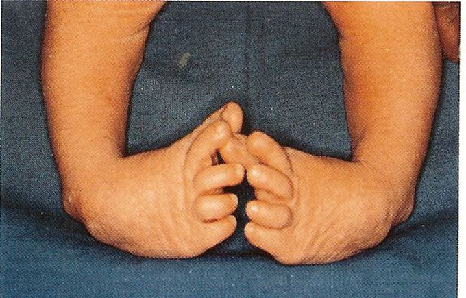 Diagnosis????
