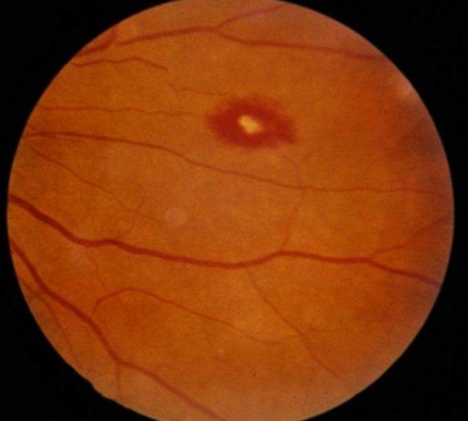 What's your diagnosis??