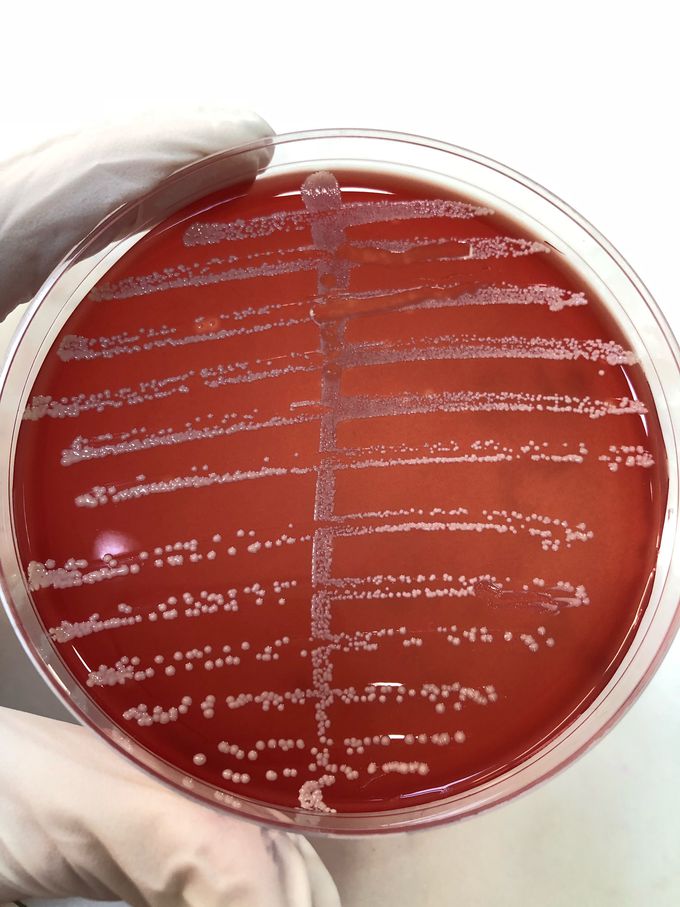 Cultivation of urine, Staphylococcus saprophyticus on blood agar. It is resintant to Novobiocin and urease test is positive.
