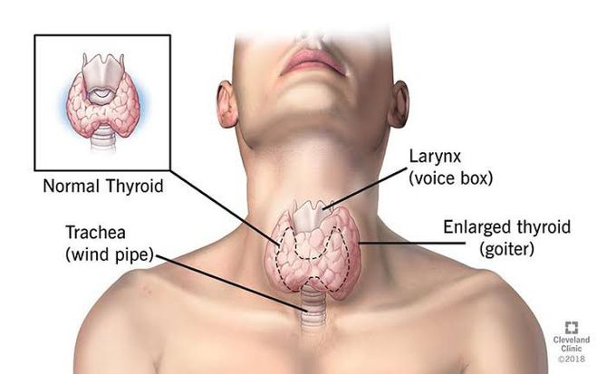 Symptoms of hypothyroidism