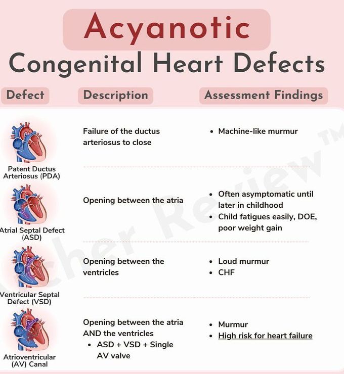 Acynotic Congenital Heart Defect