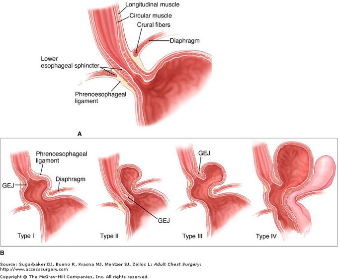 Chest Muscles (Pictures McGraw Hill) Diagram, Quizlet