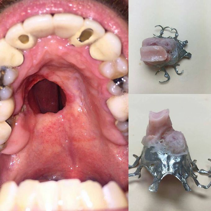 Cocaine snorters will know whats this,but this case is different!