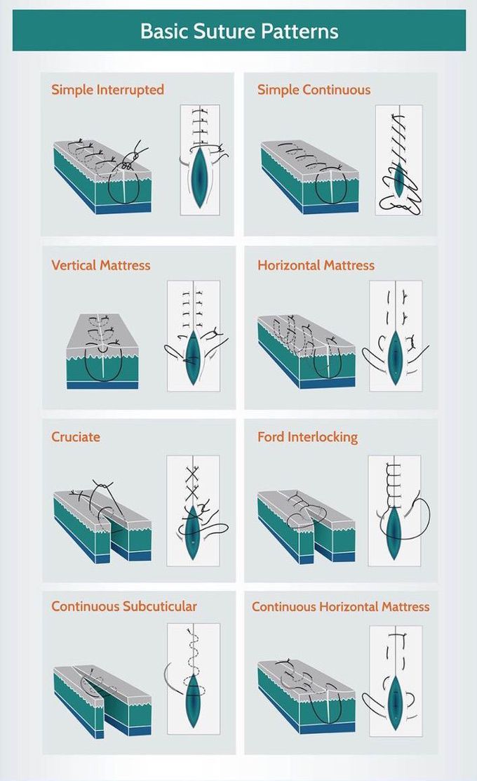 Basic Suture patterns