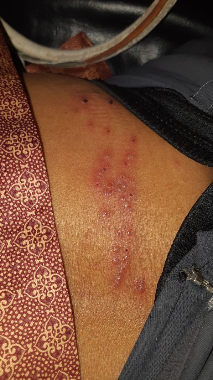 What is your diagnosis and treatment?