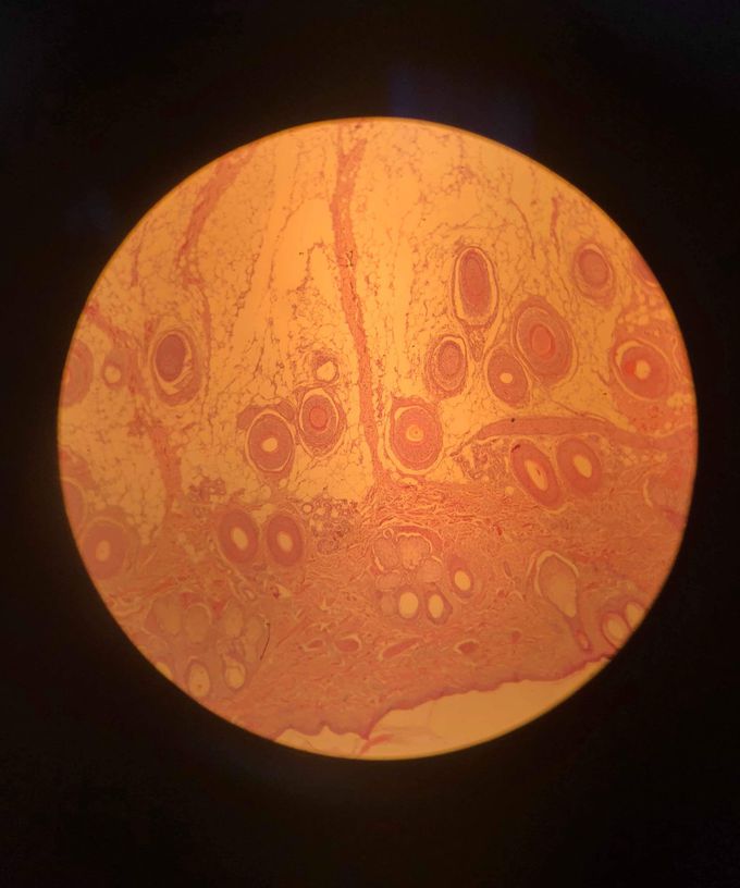 What do you think about circular structures in this preparate? What are those?