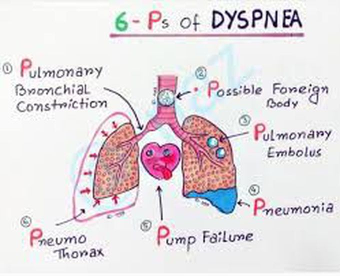 Dyspnea