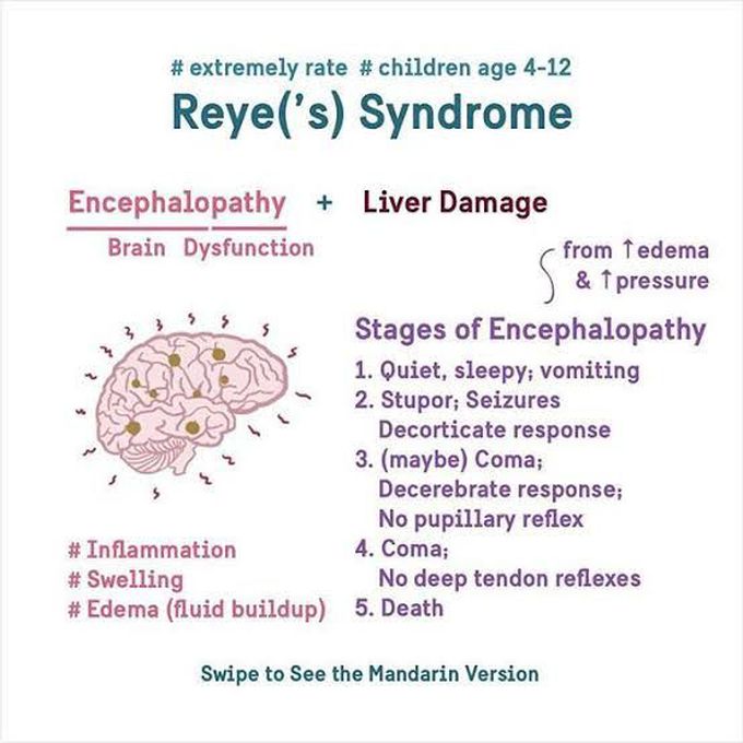 Reye's syndrome