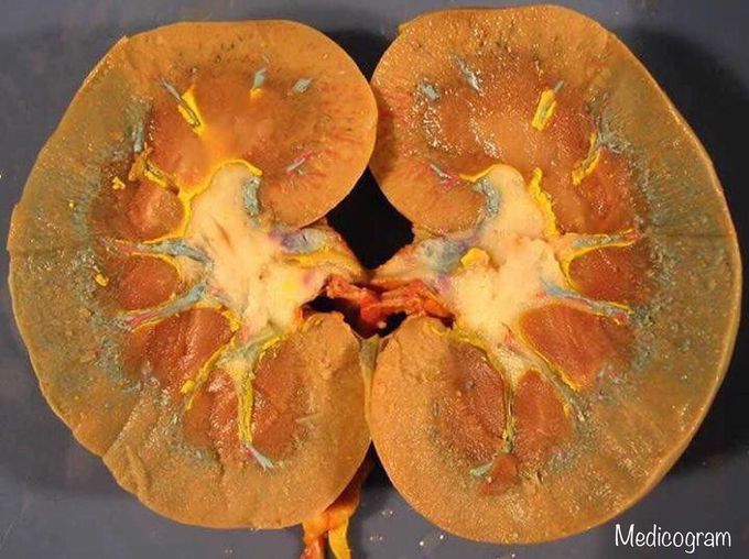 Kidney