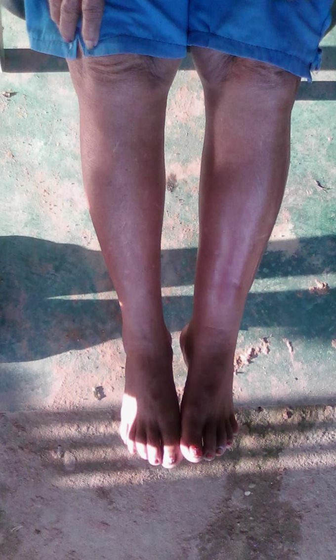 Diagnosis?