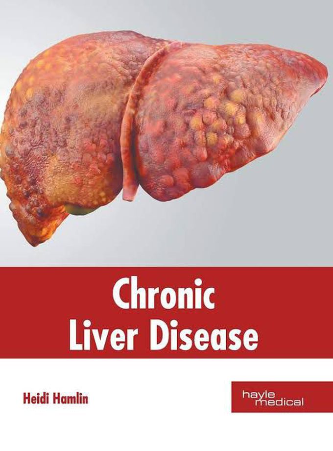 Chronic liver disease