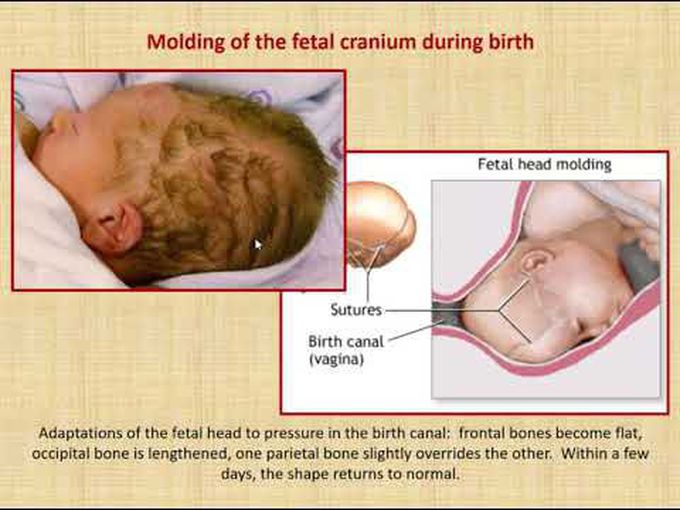 Cranium Development