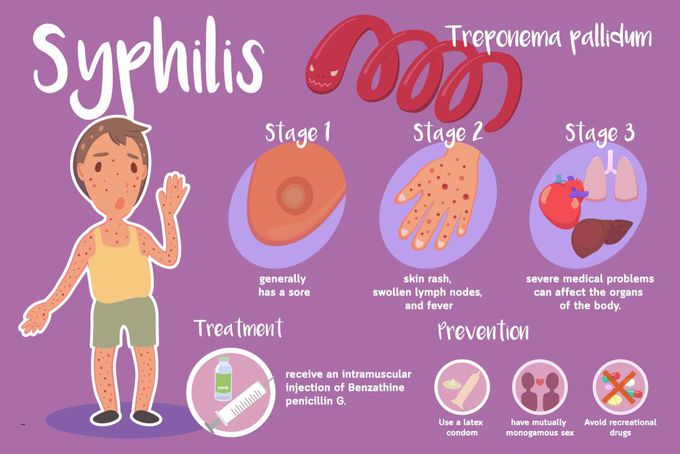 Treatment for Syphilis
