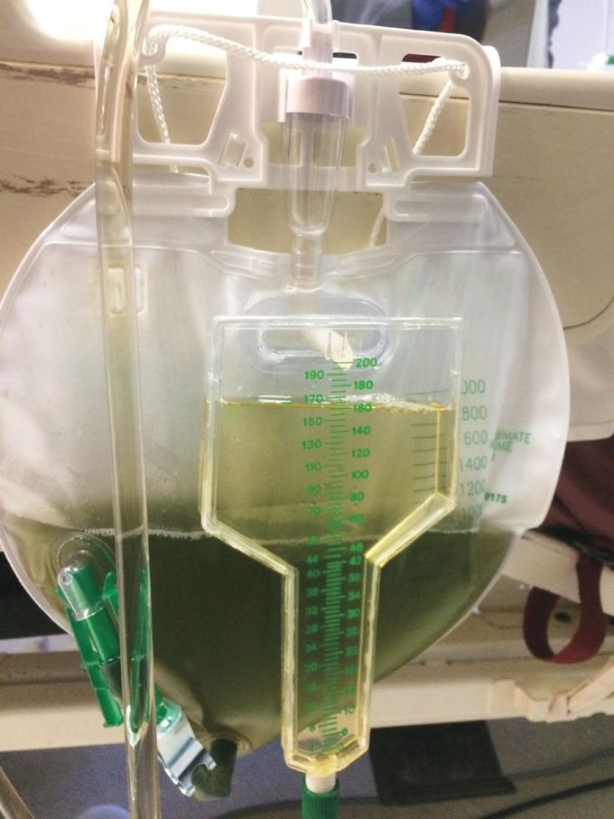 Green Urine