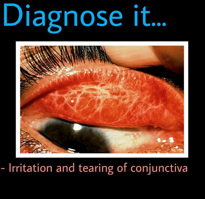 diagnosis🤗