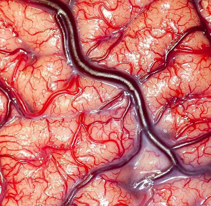 Human BRAIN....