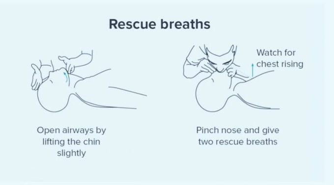 Cardiopulmonary Resuscitation IV