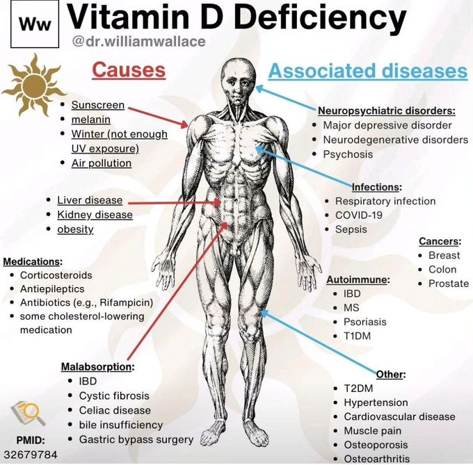 Vitamin D Deficiency