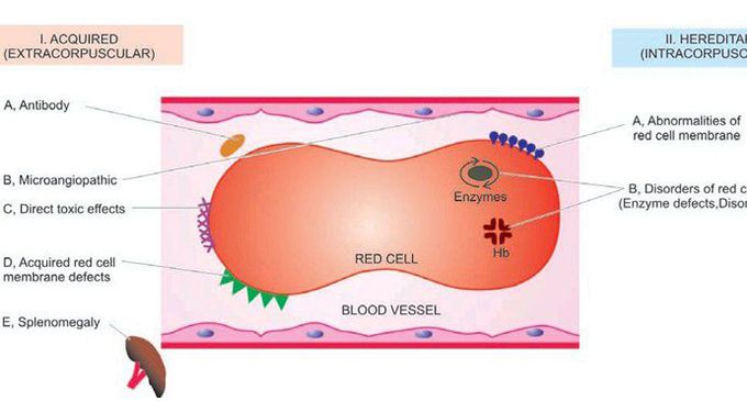 Classification of haemolytic anaemias