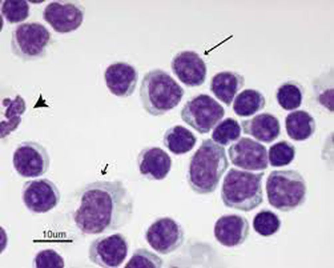 Pleocytosis