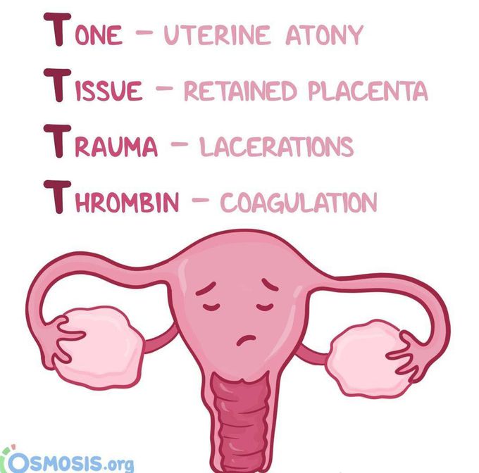 Postpartum Hemorrhage