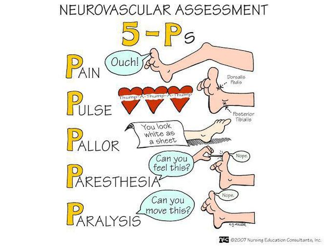 5p for Neuro muscular assements