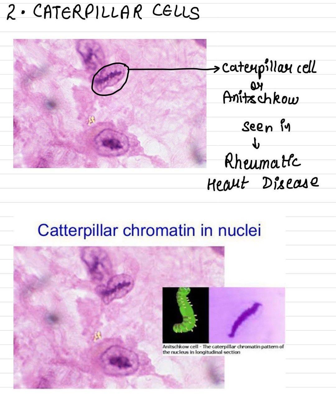 Caterpillar Cells MEDizzy