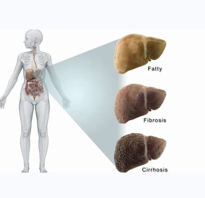 Chemicals Linked To Liver Damage⁠
⁠