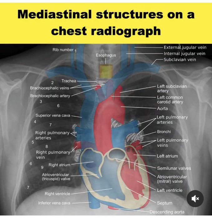 Mediastinal structures on chest radiograph