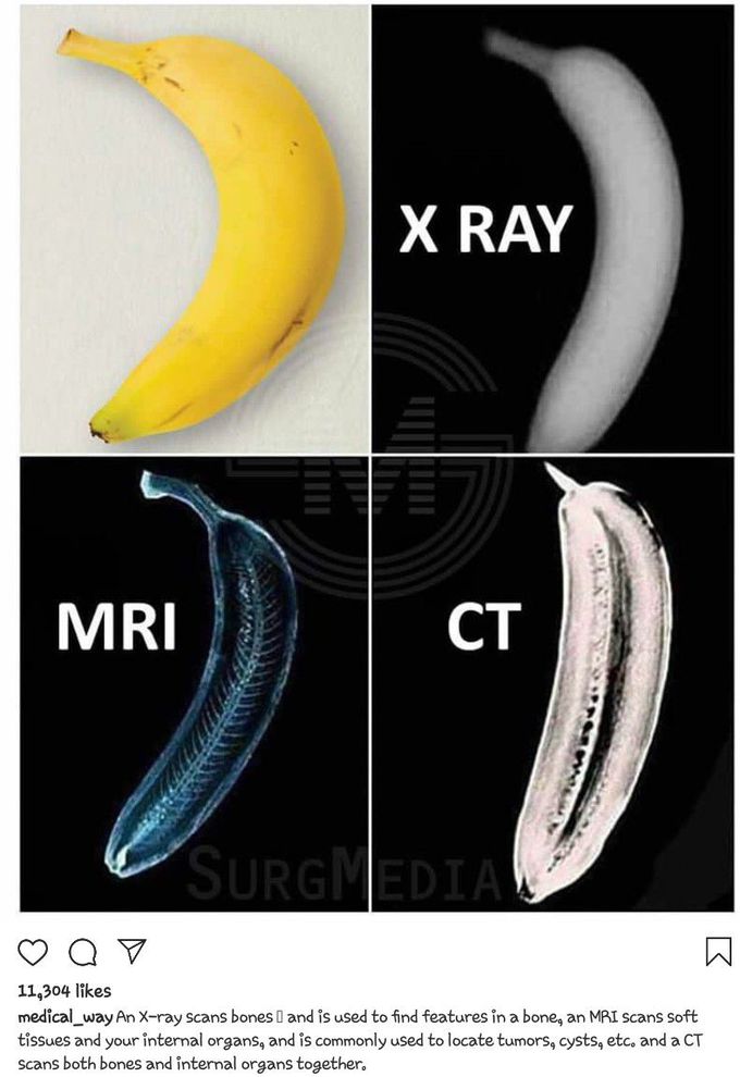 MRI, CT, X RAYS @