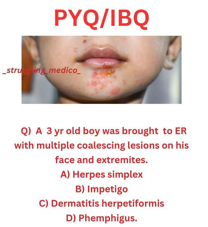 Identify the Lesions